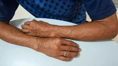 Rotina de cuidados ajuda Antônio a seguir sem álcool e retomar vínculos