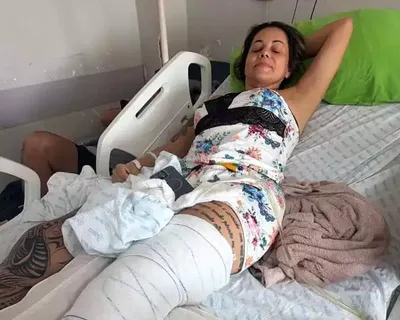 Técnica de enfermagem aguarda cirurgia após acidente com ambulância